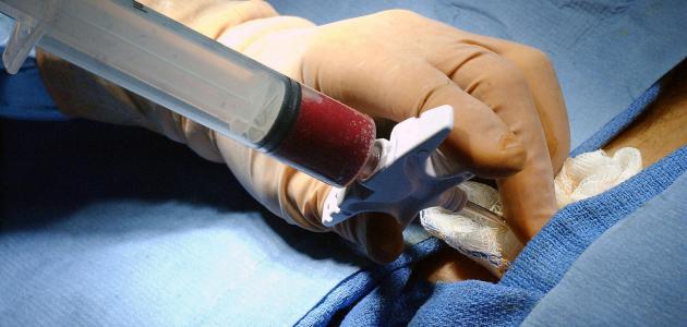 أضرار خزعة النخاع الشوكي أضرار خزعة النخاع الشوكي