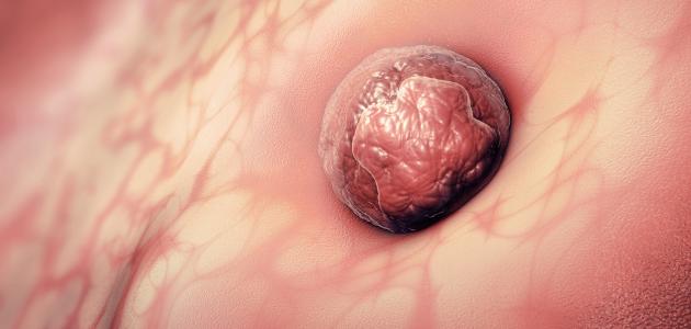 أعراض زرع البويضة في الرحم