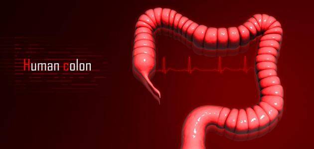 أعراض سرطان القولون أعراض سرطان القولون