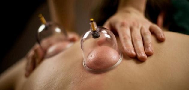 أعراض ما بعد الحجامة أعراض ما بعد الحجامة