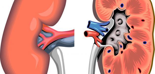 أعراض مرض الفشل الكلوي أعراض مرض الفشل الكلوي