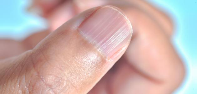 أعراض نقص الزنك