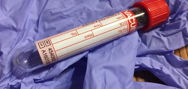 أعراض نقص الهيموجلوبين للحامل