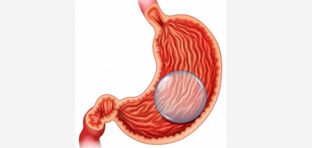 أفضل طريقة لتصغير حجم المعدة