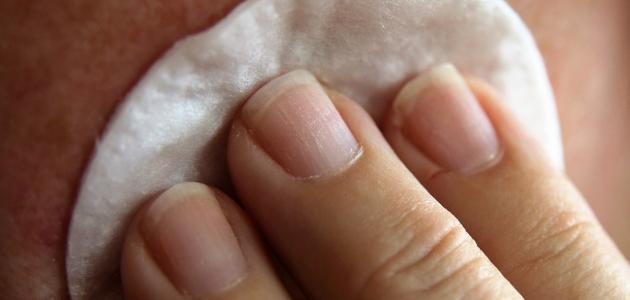 أفضل علاج النخالة البيضاء أفضل علاج النخالة البيضاء