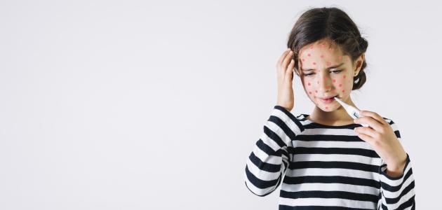 أمراض الأطفال