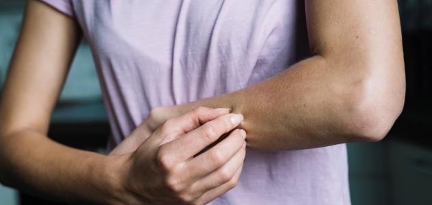 أمراض فطرية أمراض فطرية