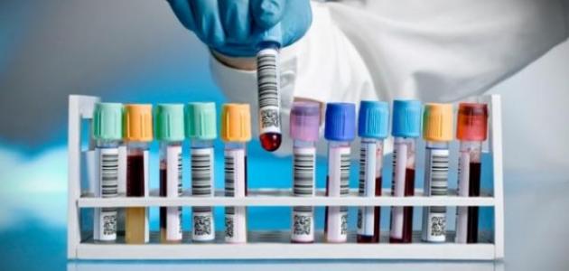 أنواع التحاليل الطبية أنواع التحاليل الطبية