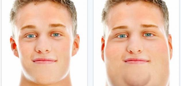 إزالة الذقن المزدوج