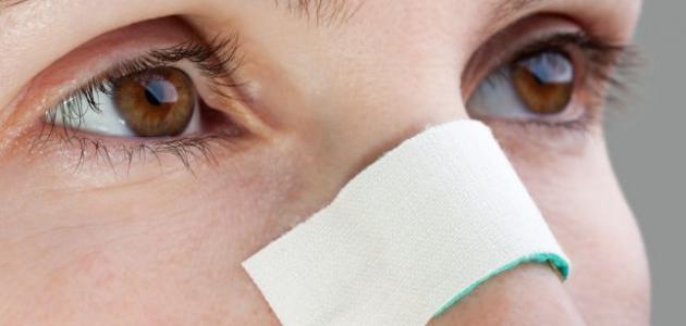 إزالة الزيوان من الوجه