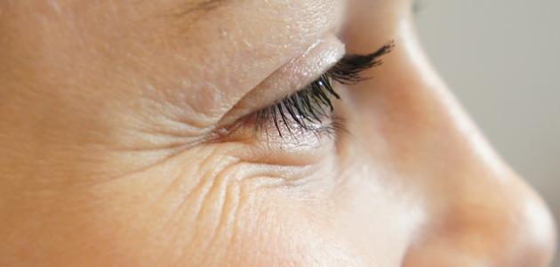 إزالة تجاعيد الوجه نهائياً