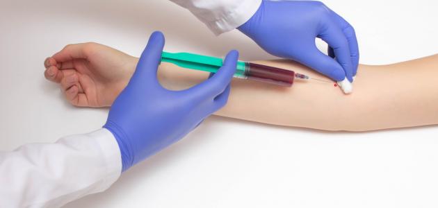 ارتفاع البروتين في الدم