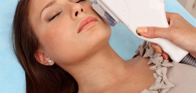 ازالة الشعر بالليزر ازالة الشعر بالليزر