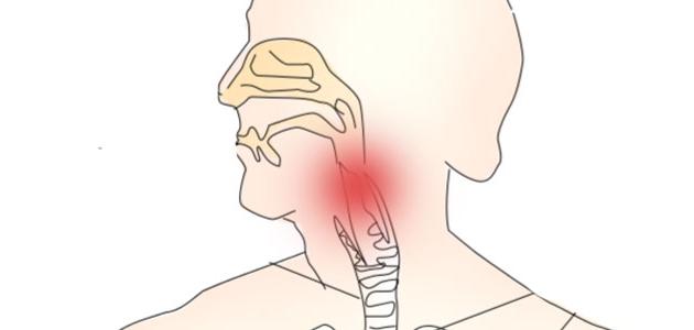 التهاب المريء التهاب المريء