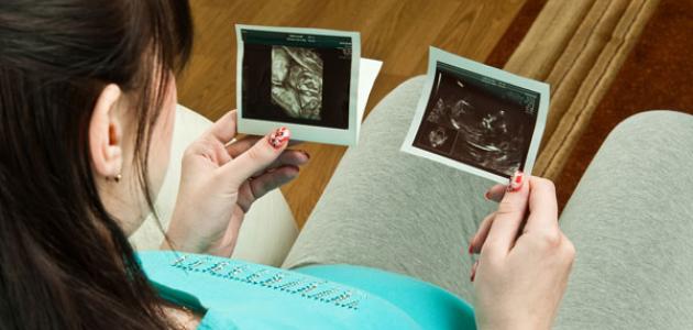 الحمل في الأسبوع الأول الحمل في الأسبوع الأول