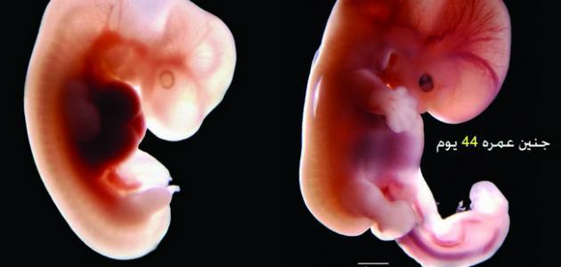 الحمل في الشهر الأول