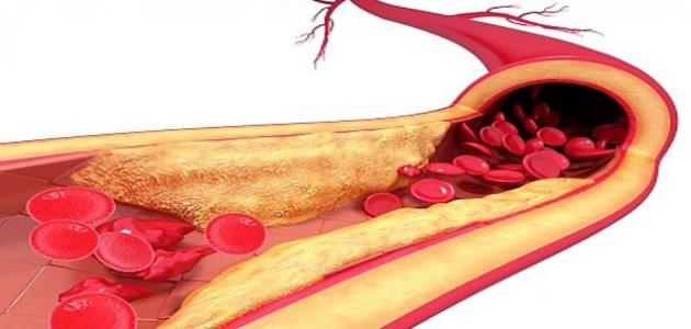 الدهون في الدم الدهون في الدم