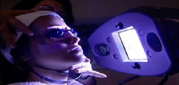 العلاج الضوئي العلاج الضوئي