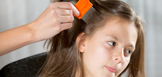 القضاء على القمل والصيبان بالأعشاب القضاء على القمل والصيبان بالأعشاب