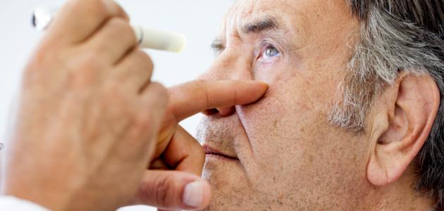 الماء البيضاء في العين