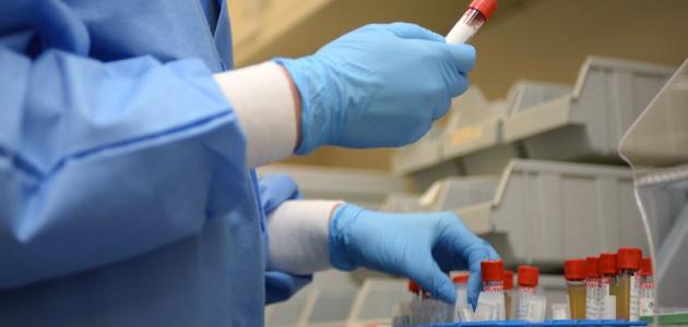 تحاليل وظائف الكلى تحاليل وظائف الكلى