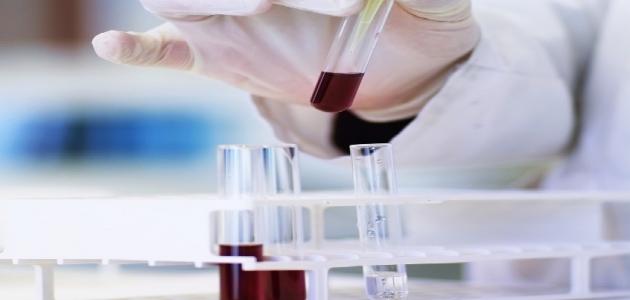 تحليل الحمل بالدم تحليل الحمل بالدم