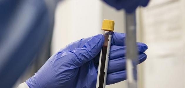 تحليل الدم لمعرفة الحمل تحليل الدم لمعرفة الحمل