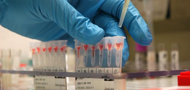 تحليل الزنك تحليل الزنك