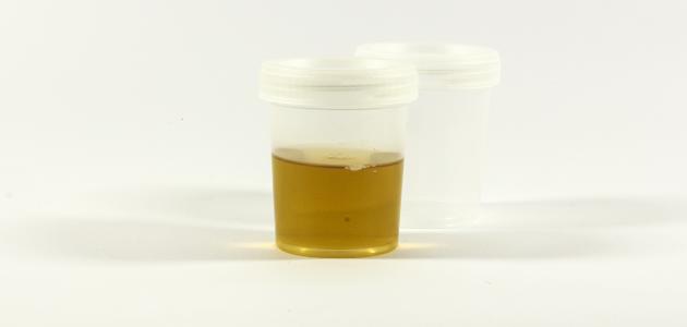 تحليل السيلان تحليل السيلان