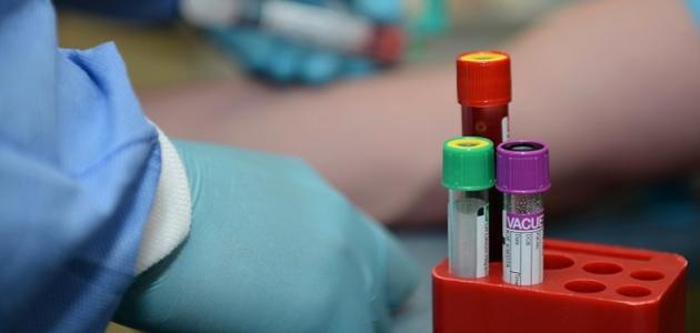 تحليل ace تحليل ace