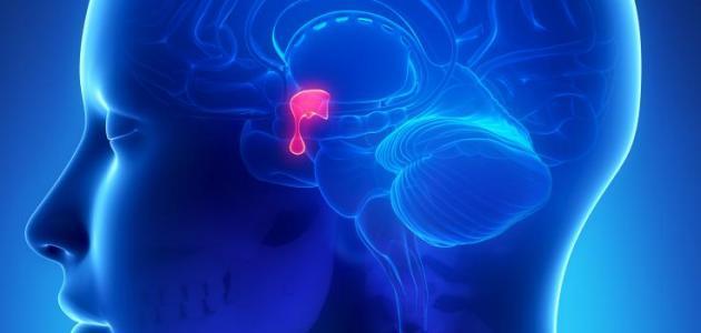 تشخيص أورام الغدة النخامية