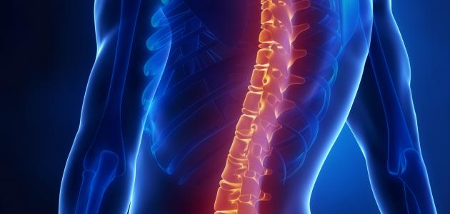 تشوهات العمود الفقري تشوهات العمود الفقري