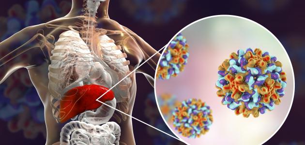 تضخم الكبد والطحال