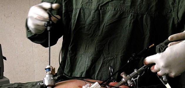 جراحة المنظار جراحة المنظار