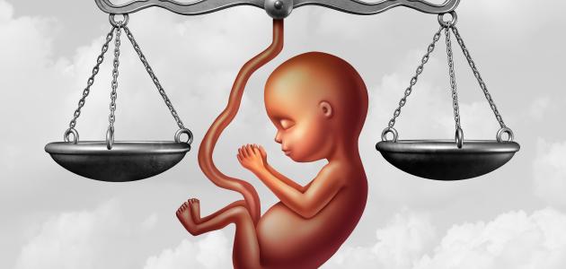 حق الحياة في الإسلام