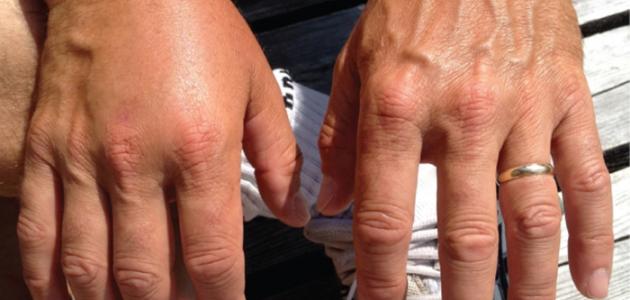 رجيم التخلص من الماء الزائد رجيم التخلص من الماء الزائد