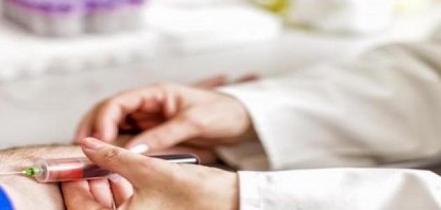 زيادة الكرياتينين في الدم زيادة الكرياتينين في الدم