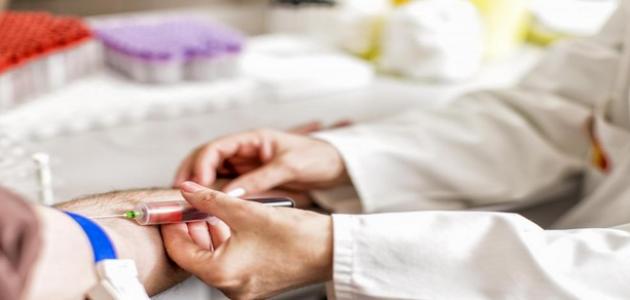 زيادة الكرياتين في الدم