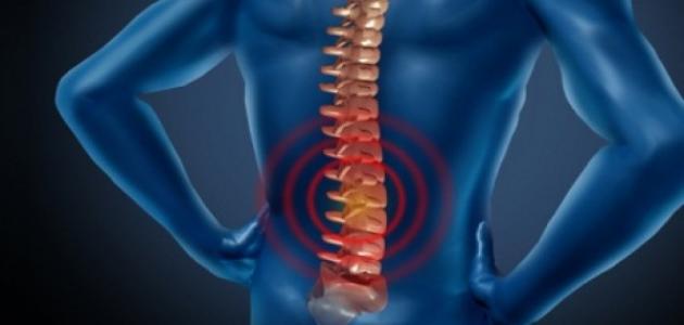 سرطان العمود الفقري سرطان العمود الفقري