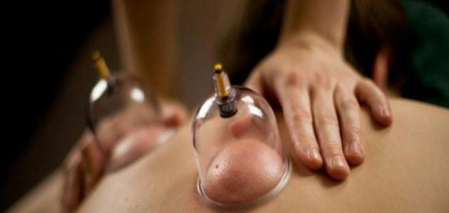 شروط الحجامة للرجال