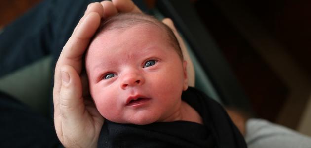 صغر حجم رأس الطفل صغر حجم رأس الطفل