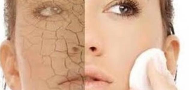 طرق العناية بالبشرة الجافة