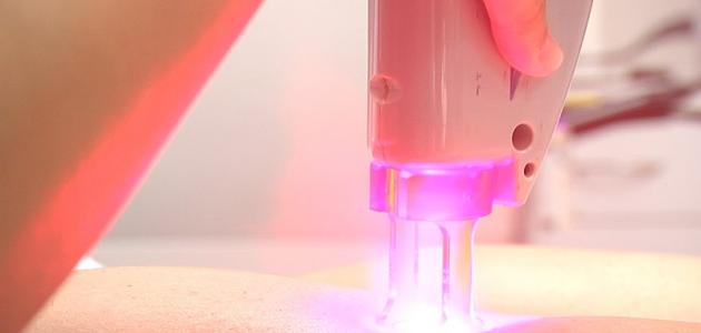 طريقة إزالة الشعر القصير جداً