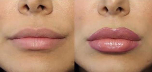 طريقة نفخ الشفاه في البيت