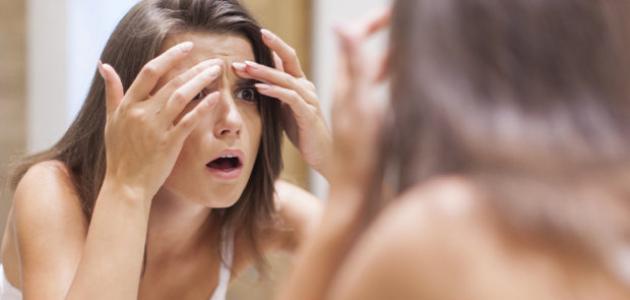 ظهور حبوب في الوجه أثناء الحمل ظهور حبوب في الوجه أثناء الحمل