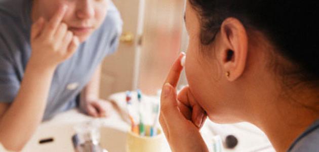 علاج آثار حب الشباب علاج آثار حب الشباب