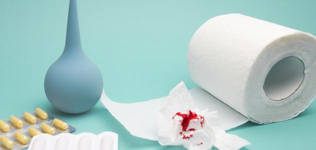 علاج البواسير علاج البواسير