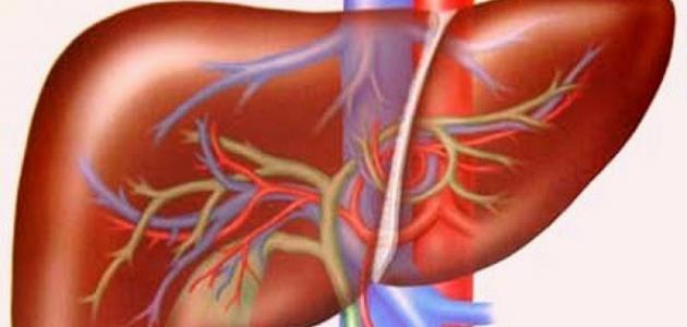 علاج الكبد علاج الكبد