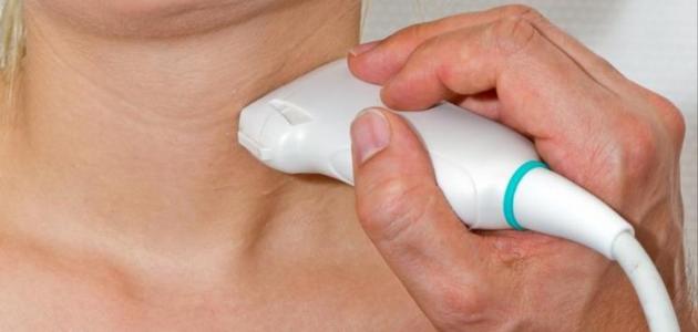 علاج تضخم الغدة الدرقية علاج تضخم الغدة الدرقية