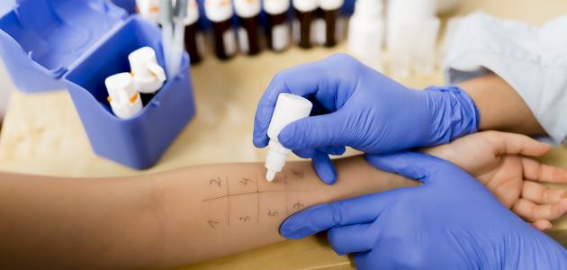 علاج حساسية الأدوية علاج حساسية الأدوية